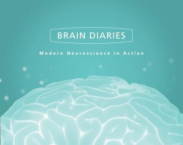 Brain Diaries exhibition poster